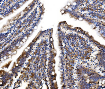 MLX-interacting protein/MLXIP Antibody