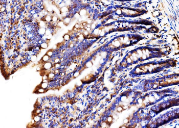 MLX-interacting protein/MLXIP Antibody