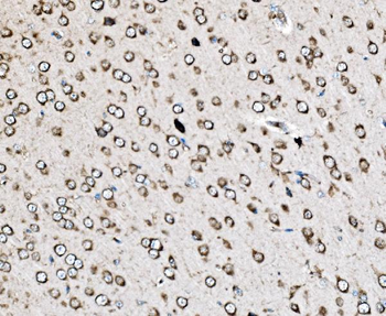 MRPS25 Antibody