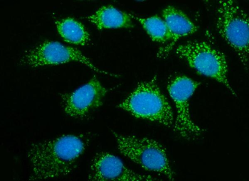 MRPS25 Antibody