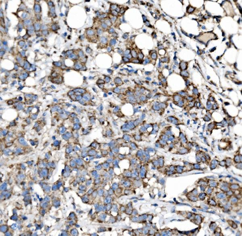 MRPS25 Antibody