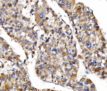 MRPS25 Antibody