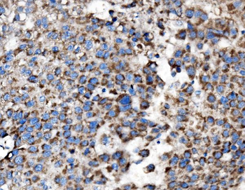 MRPS25 Antibody