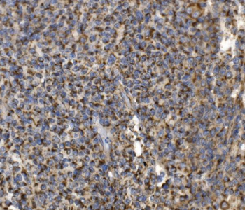 MRPS25 Antibody
