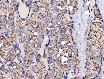 MRPS25 Antibody