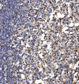 MRPS25 Antibody