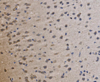 MRPS25 Antibody