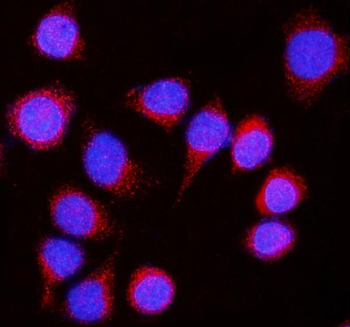 Nicastrin/NCSTN Rabbit Polyclonal Antibody