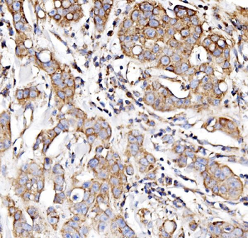 NDUFAF1 Antibody
