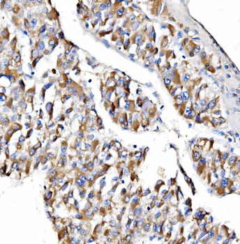 NDUFAF1 Antibody