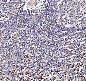 NDUFAF1 Antibody