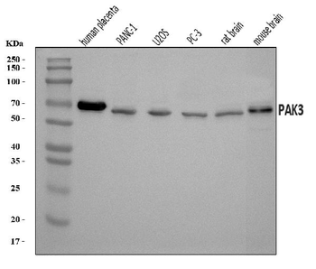 PAK3 Antibody