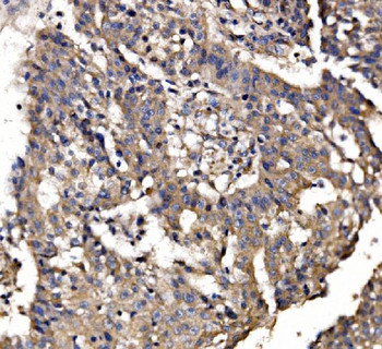 PAR-3/PARD3 Antibody