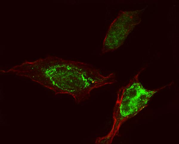 PEPP2/PLEKHA5 Rabbit Polyclonal Antibody