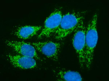 PMPCA/INPP5 Antibody