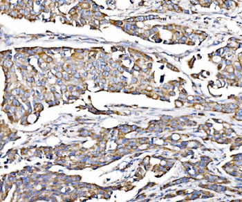 PMPCA/INPP5 Antibody