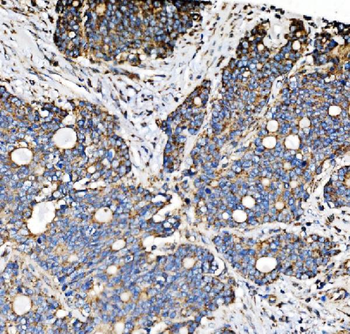 PMPCA/INPP5 Antibody