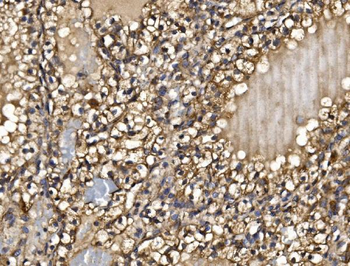 PMPCA/INPP5 Antibody