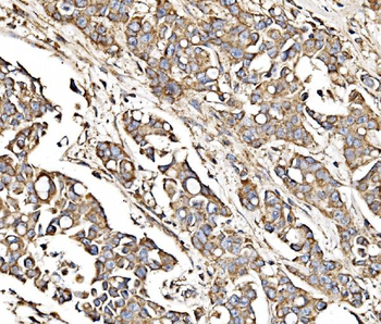 MPPB/PMPCB Antibody