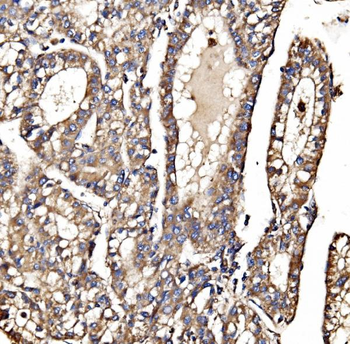 MPPB/PMPCB Antibody