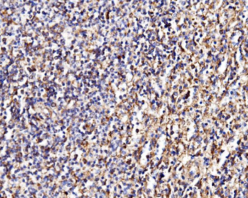 MPPB/PMPCB Antibody