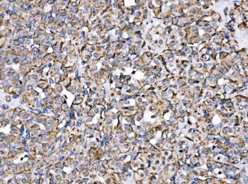 MPPB/PMPCB Antibody