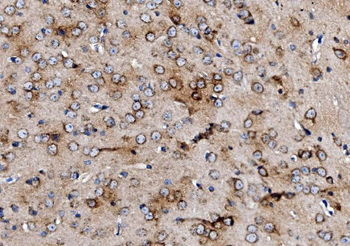 MPPB/PMPCB Antibody