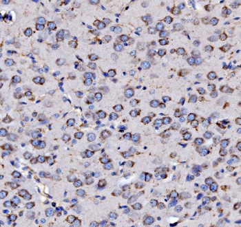 MPPB/PMPCB Antibody