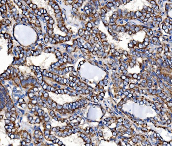Paxillin/PXN Antibody