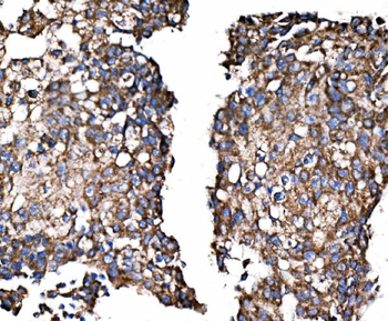 Paxillin/PXN Antibody