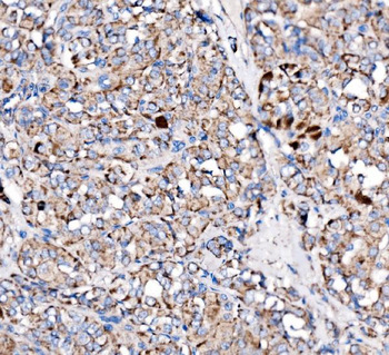 Paxillin/PXN Antibody