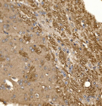 Paxillin/PXN Antibody