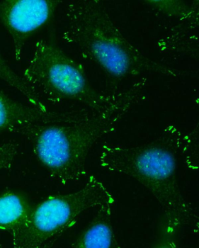 QSOX2 Rabbit Polyclonal Antibody