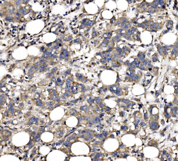 QSOX2 Rabbit Polyclonal Antibody