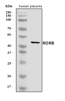 ROR beta/RORB Rabbit Polyclonal Antibody