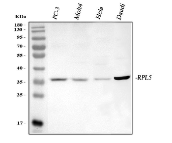 RPL5 Rabbit Polyclonal Antibody