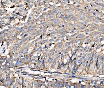 RPL17 Antibody