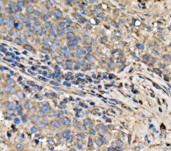 RPL17 Antibody