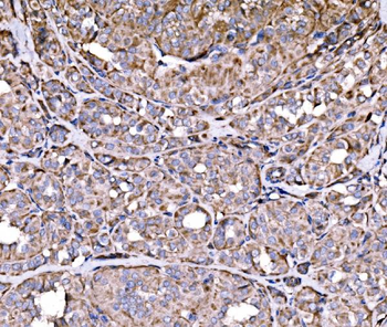 RPL17 Antibody