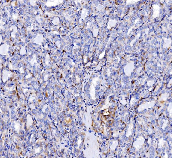 SH3GL2 Antibody