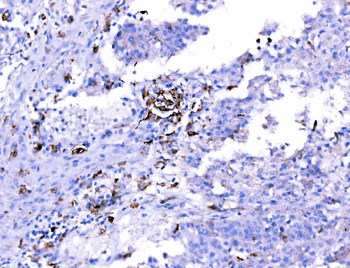SH3GL2 Antibody