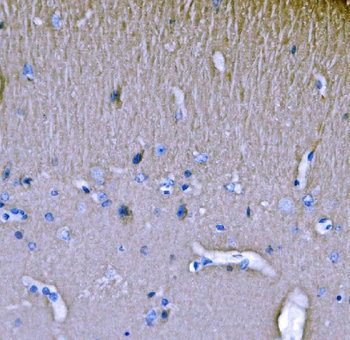 SH3GL2 Antibody
