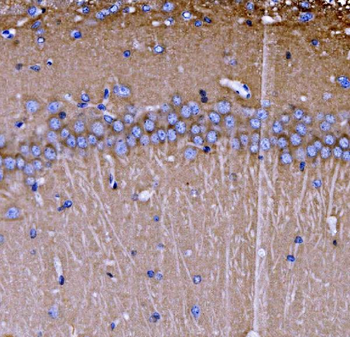 SH3GL2 Antibody