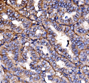 NEAS/SPTAN1 Antibody