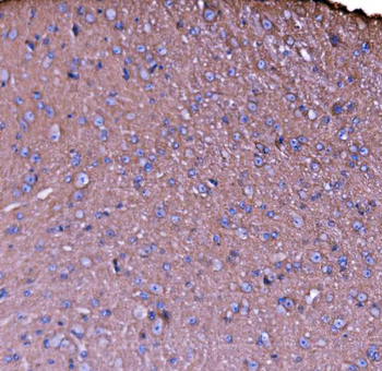 NEAS/SPTAN1 Antibody