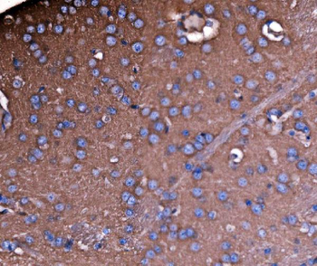 NEAS/SPTAN1 Antibody