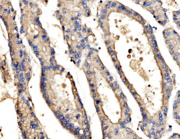 SRP72 Rabbit Polyclonal Antibody