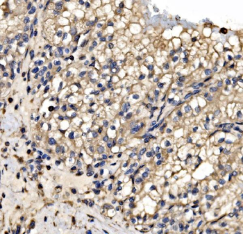 SRP72 Rabbit Polyclonal Antibody