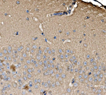 SRP72 Rabbit Polyclonal Antibody