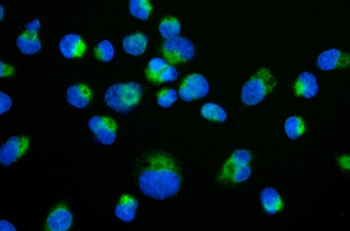 TIMM29 Rabbit Polyclonal Antibody